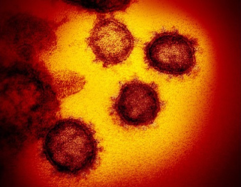 世界中で猛威をふるう新型コロナウイルス（SARS-CoV-2）の電子顕微鏡画像（米国立アレルギー感染症研究所（NIAID）提供）