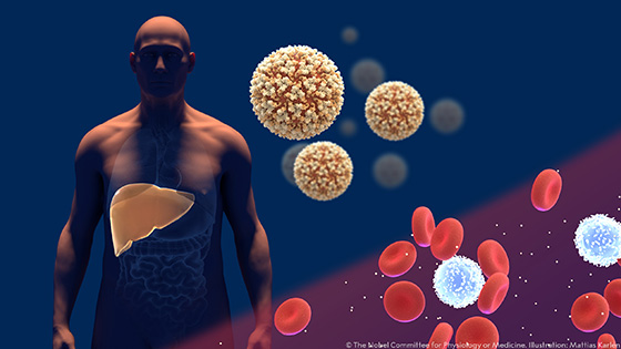 C型肝炎ウイルスは重い肝疾患を引き起こす（ノーベル財団提供）(c) The Nobel Committee for Physiology or Medicine. Illustration: Mattias Karlen.