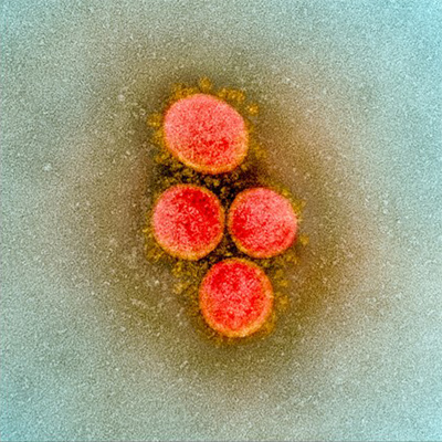 新型コロナウイルスの電子顕微鏡撮影画像（NIAID提供）