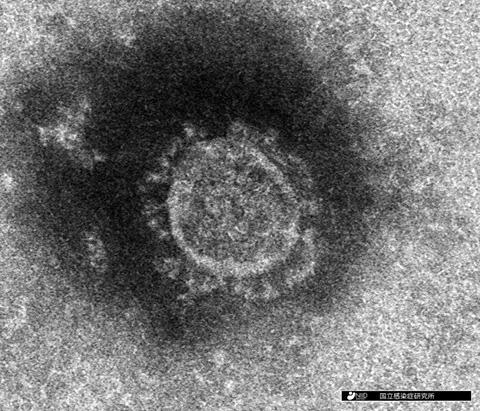 国立感染症研究所で分離された新型コロナウイルスの電子顕微鏡画像。粒状の粒子の上にコロナウイルス特有の冠状のスパイクタンパク質が観察できる（国立感染症研究所提供）