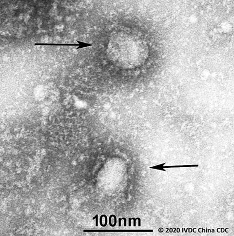 新型コロナウイルスの電子顕微鏡画像（GISAID/中国疾病予防管理センター（中国CDC）・IVDC提供）