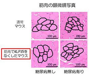 4枚の顕微鏡写真のうち右上の「糖尿病マウス」は筋肉が減少し、筋繊維が縮小している(提供・神戸大学大学院の研究グループ/神戸大学)