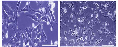 画像 がん幹細胞から分化して生まれた“がん関連線維芽細胞(CAF)”。左はスケールバーが: 200μm、右は同100μm(提供・岡山大学研究グループ)
