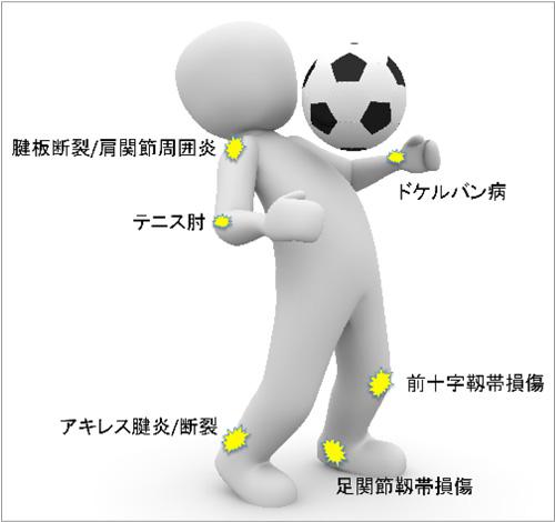 図1 主な腱や靭帯の病気・けがと部位(東京医科歯科大学提供)