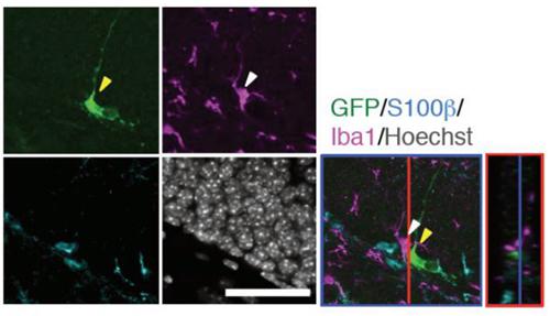 海馬の蛍光顕微鏡の写真、ミクログリア(紫)は神経幹細胞(緑)と隣接して存在している。