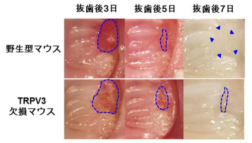 マウス口腔内の写真。TRPV3欠損マウスでは、青い線で囲まれた抜歯後の傷の面積が野生型マウスよりも広い。