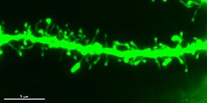 写真. 神経細胞のシナプスとスパイン。上がコモンマーモセット神経細胞の樹状突起スパインの蛍光顕微鏡写真、下が概念図