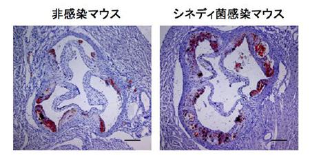 動脈硬化のモデルマウスで見たシネディ菌感染(右)の動脈硬化促進