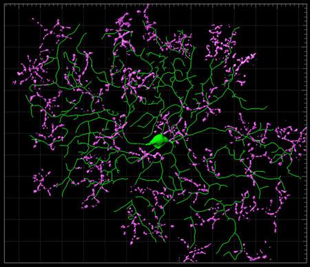 可視化された網膜の狭棘状細胞(緑)とDB6細胞(ピンク)