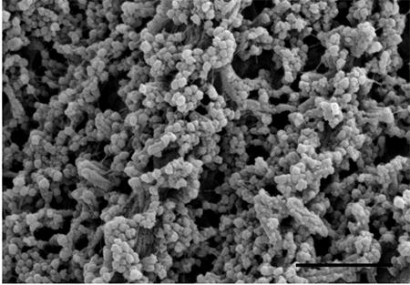 ヒトから分離されたH7N9ウイルスの走査型電子顕微鏡写真(黒いバーは1マイクロメートル〈1000分の1ミリメートル〉) 　(提供：東京大学 医科学研究所) 