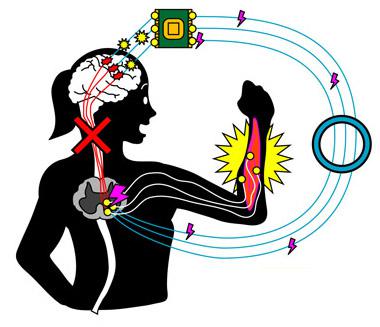 開発した神経バイパス技術の模式図
(提供：生理学研究所)