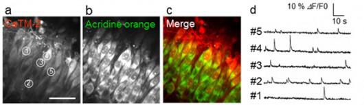 ラット脳スライス切片における神経細胞の自然発火の画像化(提供：科学技術振興機構) 
 (a-c)CaTM-2の蛍光像(a)、細胞体を同定するために用いたアクリジンオレンジの蛍光像(b)および、重ね合わせた蛍光像(c)。(d)CaTM-2の蛍光強度の時間変化。(a)内に示した1〜5の位置において、神経細胞の発火に伴う細胞内カルシウムイオン濃度の変動を蛍光強度の変化として捉えることに成功している。 