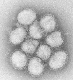 A型の一種で2009年に新型として大流行したH1N1型ウイルスの電子顕微鏡画像(国立感染症研究所提供)