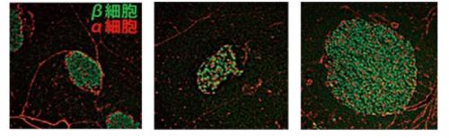 画像 左は正常マウス、中央は糖尿病モデルマウス、右は酵素(Elovl6)欠損糖尿病モデルマウスの膵臓組織。欠損マウスは緑色のβ細胞が増殖している(提供・筑波大学/同大学研究グループ)