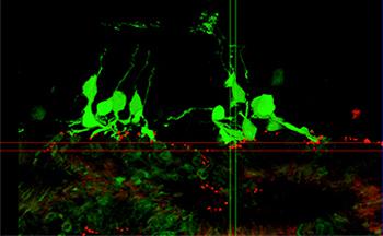 画像 マウスiPS細胞から分化させた網膜組織を移植した網膜変性末期マウスの網膜のシナプス形成の様子(理研提供)