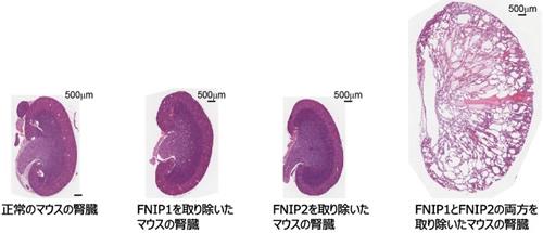 正常なマウスの腎臓と、FNIP1、FNIP2の各遺伝子をそれぞれ取り除いたマウス、FNIP1とFNIP2の両遺伝子を取り除いたマウスの腎臓
