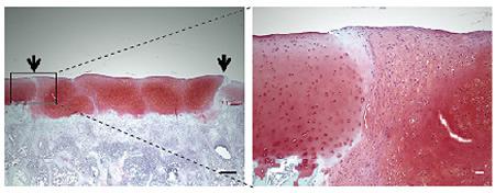 ミニブタの関節に移植した軟骨組織塊の生着を確認。関節を損傷させたミニブタに軟骨組織塊を移植し、1カ月後に関節組織を顕微鏡で観察した。矢印は生体内の軟骨と移植した軟骨組織塊との境界。右は左の顕微鏡写真の一部の拡大。スケールバーは左が500μm、右が50μm。
