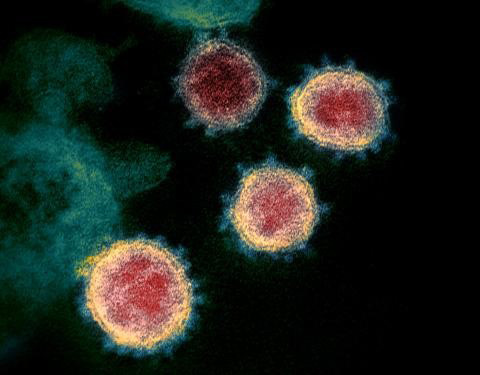 米国の患者から分離された新型コロナウイルスの電子顕微鏡画像（Credit: NIAID-RML）