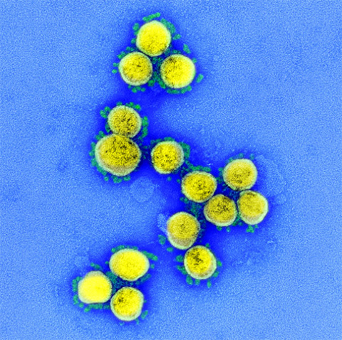 新型コロナウイルスの電子顕微鏡画像（米国立アレルギー感染症研究所（NIAID）提供）