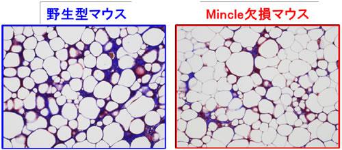 ミンクル欠損マウスでの脂肪組織線維化の抑制。脂肪組織の顕微鏡写真で、青の部分が線維化領域。左は野生型、右はミンクル欠損マウス。