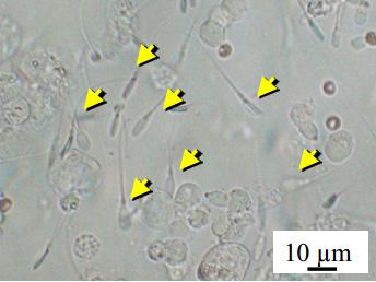 写真. ヌードマウスに移植したブタの精巣組織から回収した精子(移植後254日)(提供：図・写真とも農業生物資源研究所)