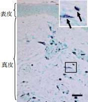 皮膚の免疫組織染色(矢印：KIAA1199発現細胞)
(提供：カネボウ化粧品)