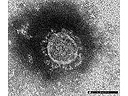 天然痘に似た症状の「サル痘」が欧米などで拡大 厚労省、国内流入を警戒