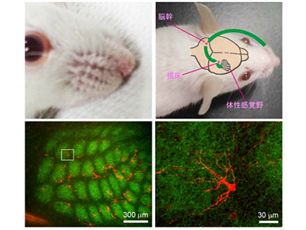 新生児の脳の神経回路成長をマウスで観察