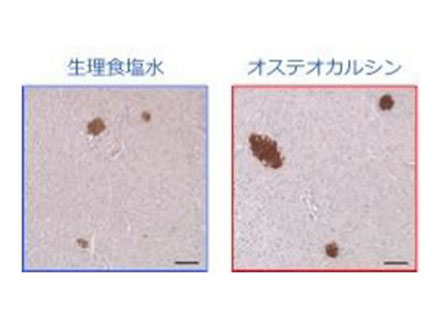 骨タンパク質の経口摂取で代謝を改善