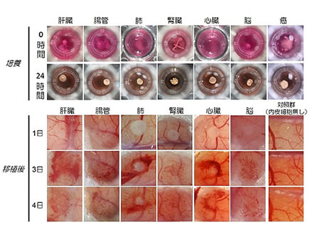 iPS細胞から目の主要部分細胞を作製 大阪大が世界初めて成功
