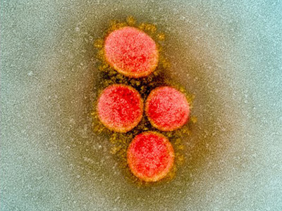 新型コロナウイルスを世界最速の5分で検出 理研と東大、京大が新検査技術を開発