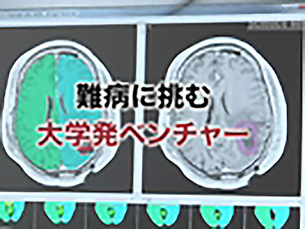サイエンスニュース2012（新着情報） 難病に挑む大学発ベンチャー（2013年1月16日配信）