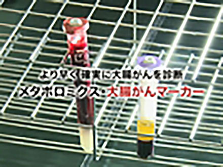 サイエンスニュース2012（新着情報） より早く、確実に大腸がんを診断 メタボロミクス・大腸がんマーカー（2013年1月23日配信）