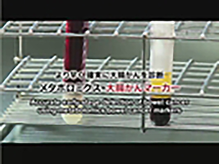 Science News 2012 （English） Earlier, Accurate Detection of Bowel Cancer Using Metabolomics Bowel Cancer Markers