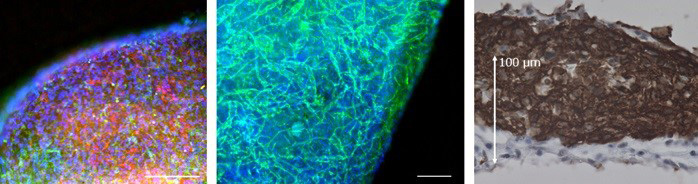 培養してできたiPS細胞由来の立体的な心臓組織。左の画像の赤色が心筋細胞、緑が血管壁細胞。中央の画像の緑色は血管内皮細胞で、血管網が形成されているのが分かる。右画像の茶色は心筋層（理化学研究所提供）