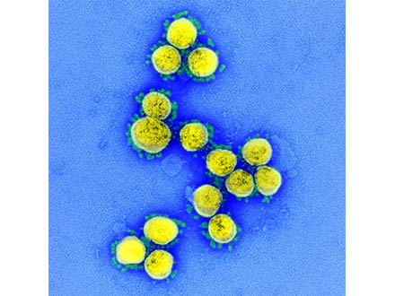 国立感染研、新型コロナウイルス変異種の分離に成功 感染力が強い恐れ