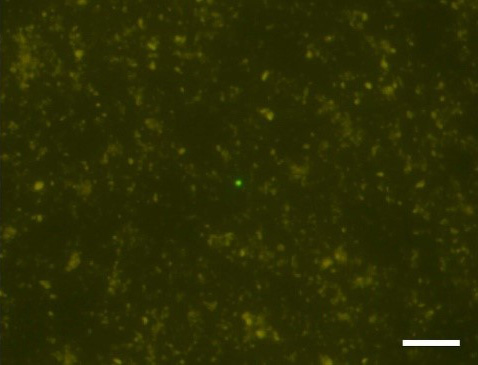 室戸岬沖の海底下1176.8メートルから検出された微生物細胞（中央に1細胞）。右下のスケールは20マイクロメートル（1マイクロは100万分の1）＝JAMSTEC提供