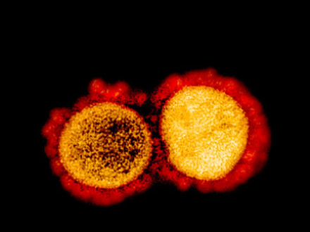 特集：新型コロナウイルス感染症<br>-COVID-19とわたしたち-