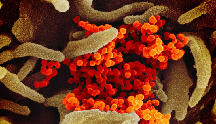 新型コロナウイルスの電子顕微鏡画像（NIAID提供）