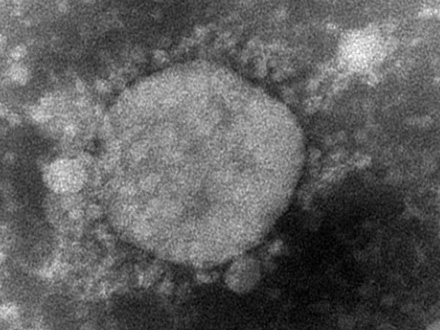 国立感染研、新型コロナウイルス変異種の分離に成功 感染力が強い恐れ