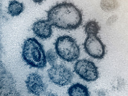 新型コロナの流行下、子どものライノウイルス感染が広がっていた 東大医科研調査