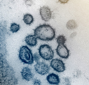 新型コロナウイルスの電子顕微鏡画像（英国で見つかった変異株のウイルスではない、NIAID提供）