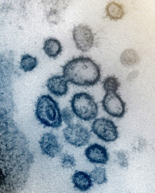 新型コロナウイルスの電子顕微鏡画像（NIAID提供）