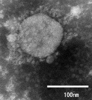 国立感染症研究所が分離した新型コロナウイルスの変異種「VOC-202012/01」の電子顕微鏡画像（国立感染研究所提供）