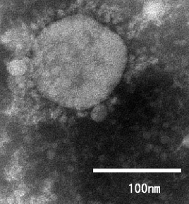 国立感染症研究所で分離された新型コロナウイルスの変異株「VOC-202012/01」の電子顕微鏡画像（国立感染症研究所提供）