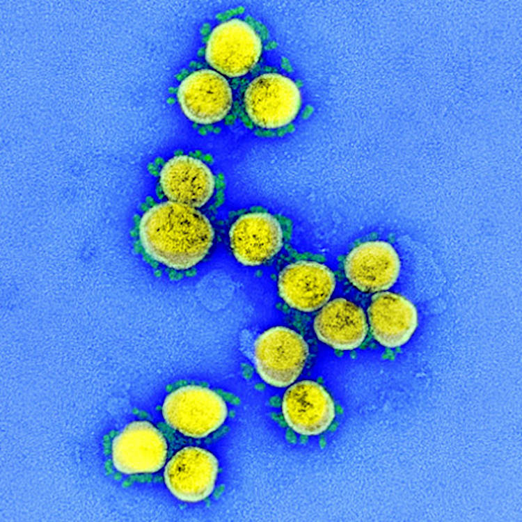 新型コロナウイルス（従来株）の電子顕微鏡画像（NIAID提供）