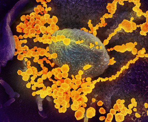新型コロナウイルス（従来株）の電子顕微鏡撮影画像。現在は世界中でさまざまなウイルス変異株が広がり、ワクチン接種が進んでもパンデミックがなかなか収束しない大きな要因になっている（NIAID提供）