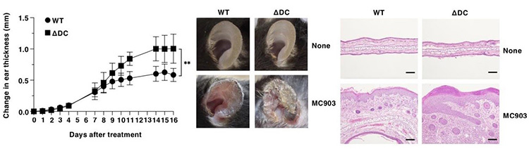 マウスの耳にアトピー性皮膚炎を起こす薬（MC903）を塗った実験。WTは健康な、ΔDCは樹状細胞を欠いたマウス。左のグラフは皮膚の腫れ具合を示す。中央の耳の写真や、右の皮膚組織の写真から、樹状細胞のない方が症状が悪化したことが分かる（宮崎大学提供）