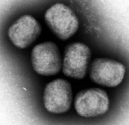 サル痘ウイルスの電子顕微鏡写真（国立感染症研究所提供）