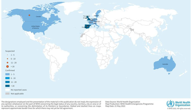 WHOが21日公表したサル痘患者の発生地図（WHO提供）